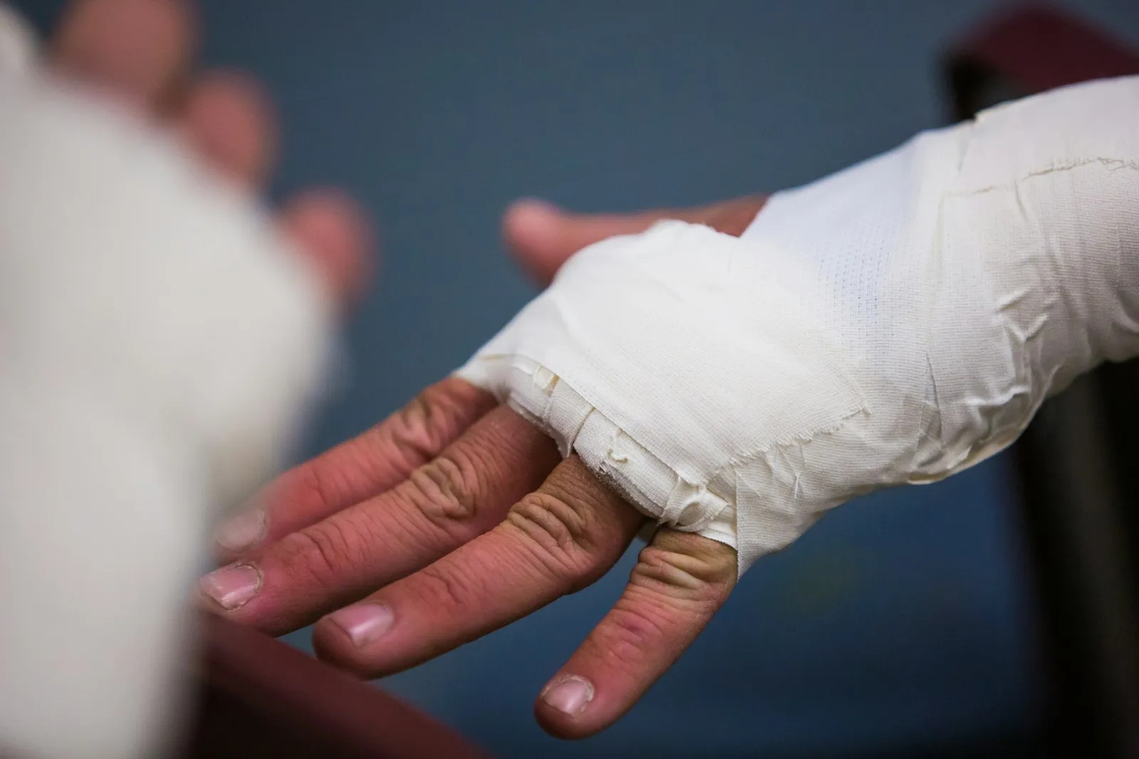 Mano con vendaje tras una fractura de muñeca
